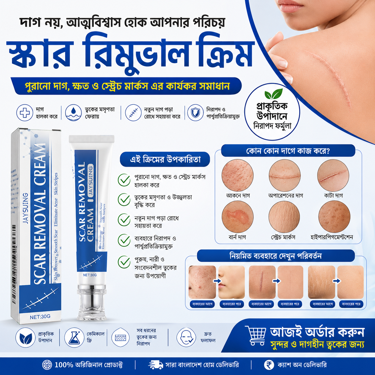 Jaysuing Scar Removal Cream – Skin Repair Cream 30g