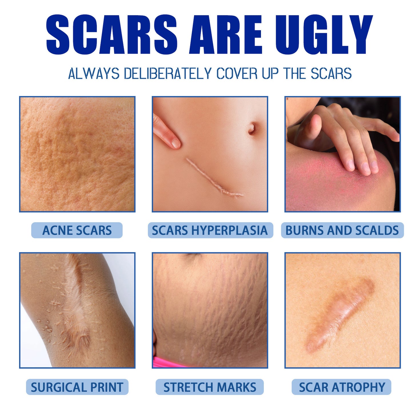 Jaysuing Scar Removal Cream – Skin Repair Cream 30g